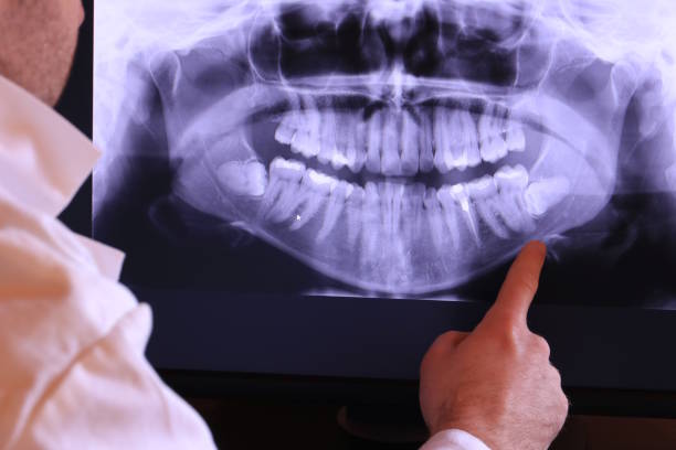 Best Dentist for Dental Trauma  in Watonga, OK