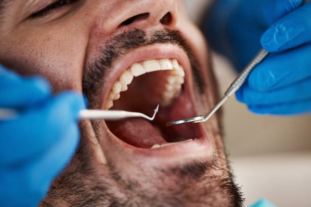 Professional Emergency Dentist in OK